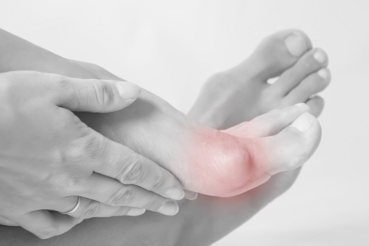 What Does Bunion Pain Feel Like? Northwest Surgery Center