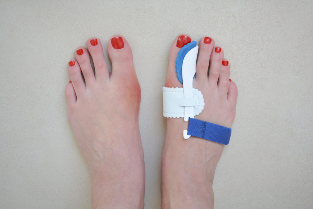 How Effective Are Bunion Pads? Northwest Surgery Center