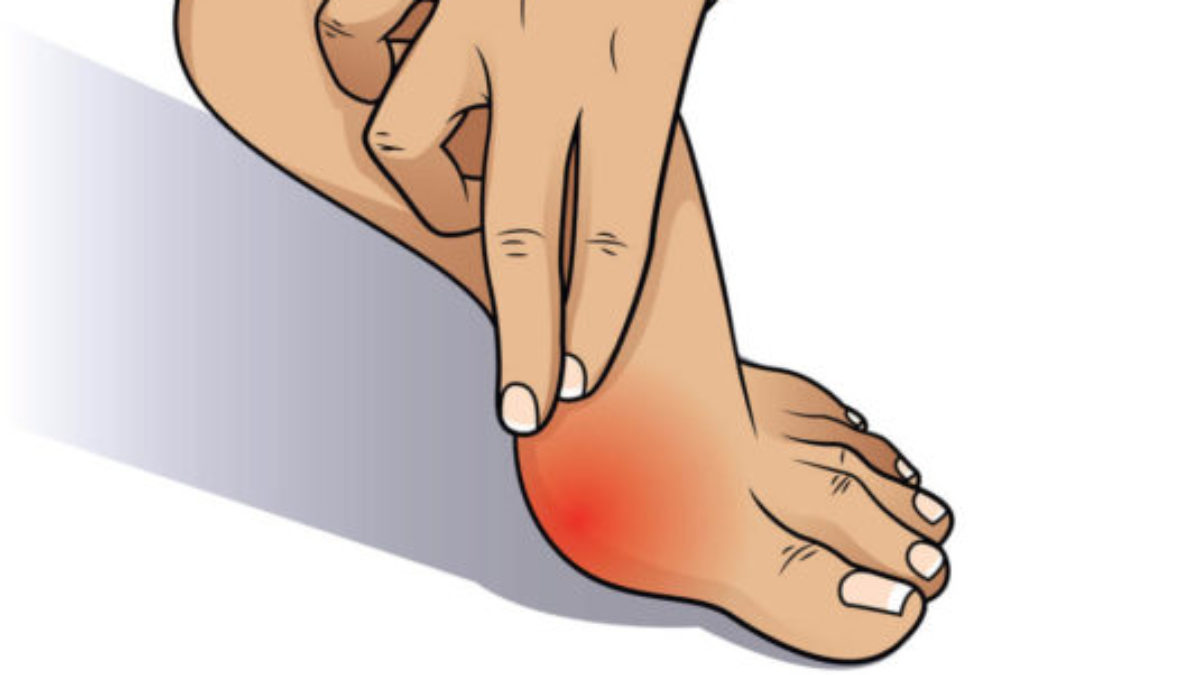 Throbbing bunion pain at night discount