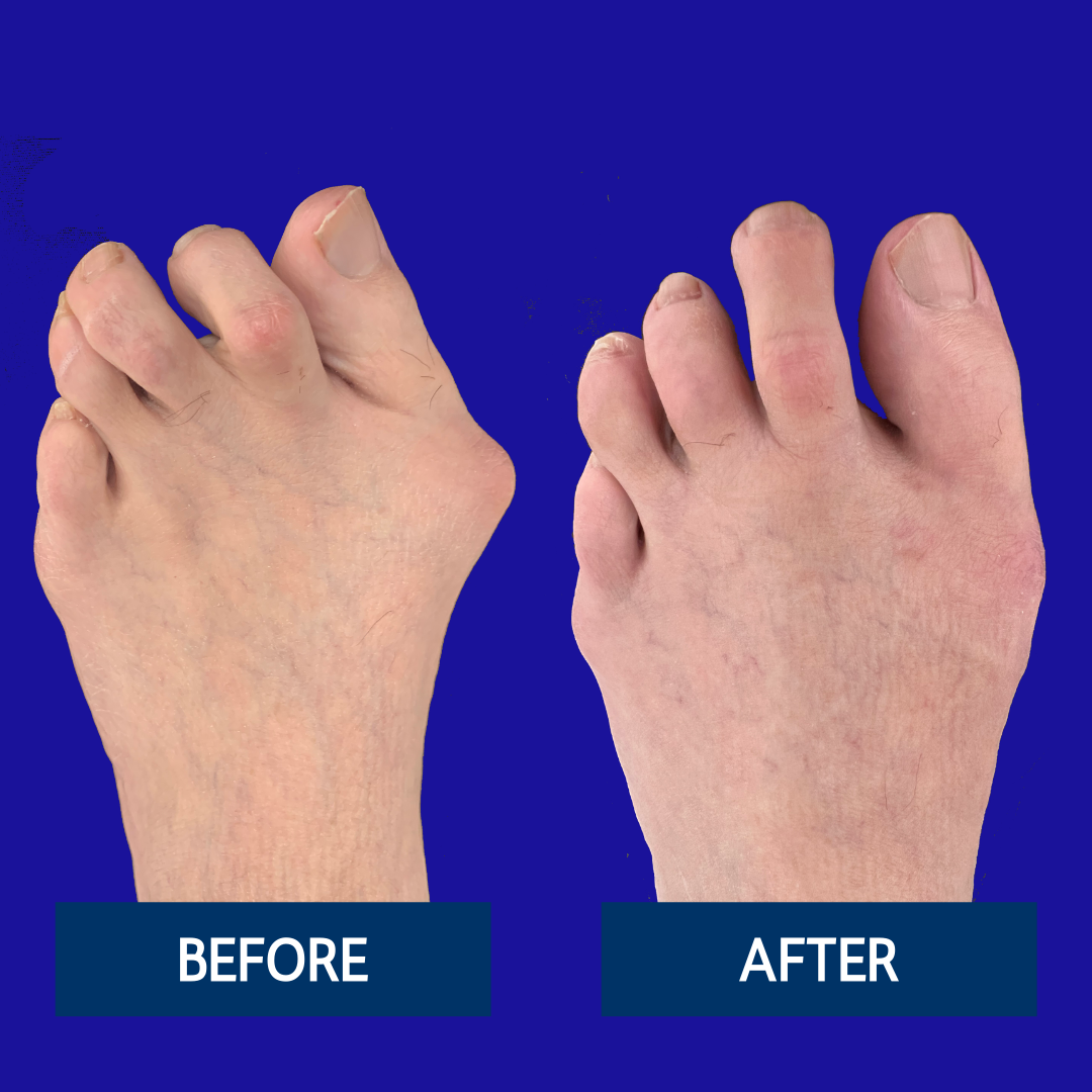Copy of NWSC Before & After (3) (2)