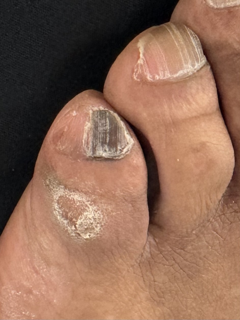 After Surgery