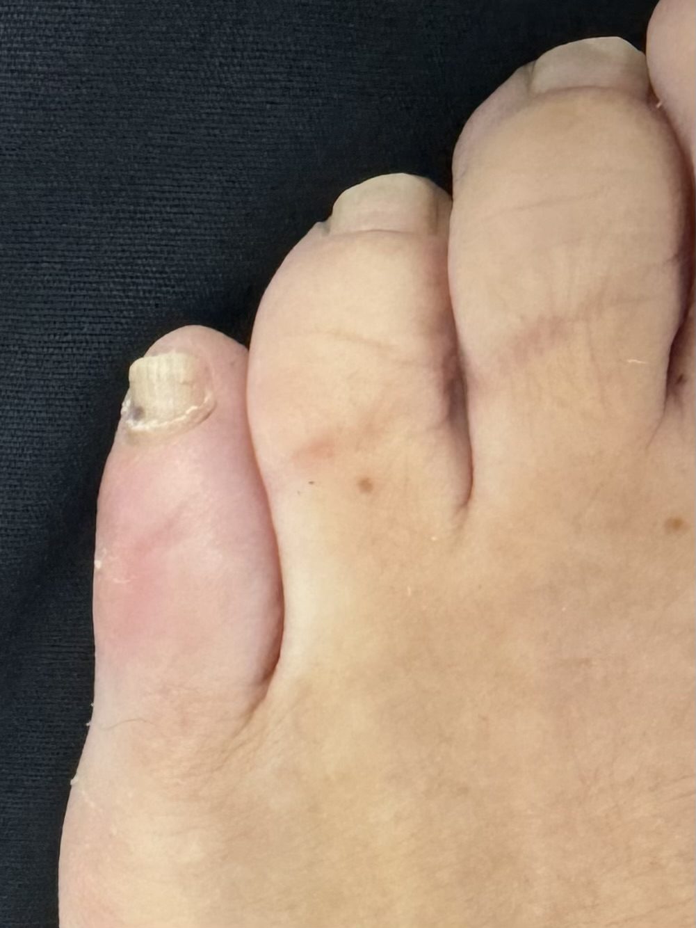 After Surgery