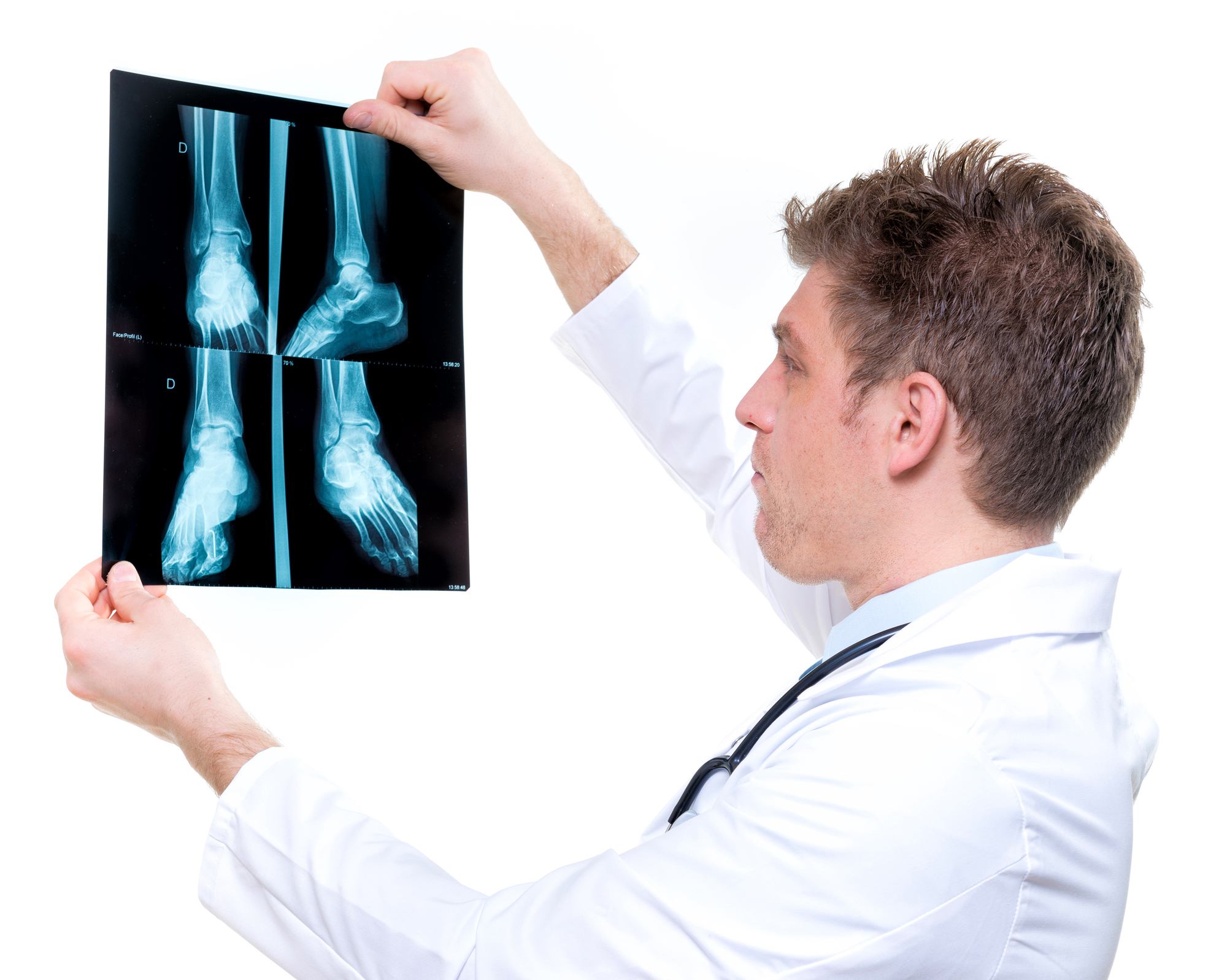 Podiatrist Reviewing an X-ray