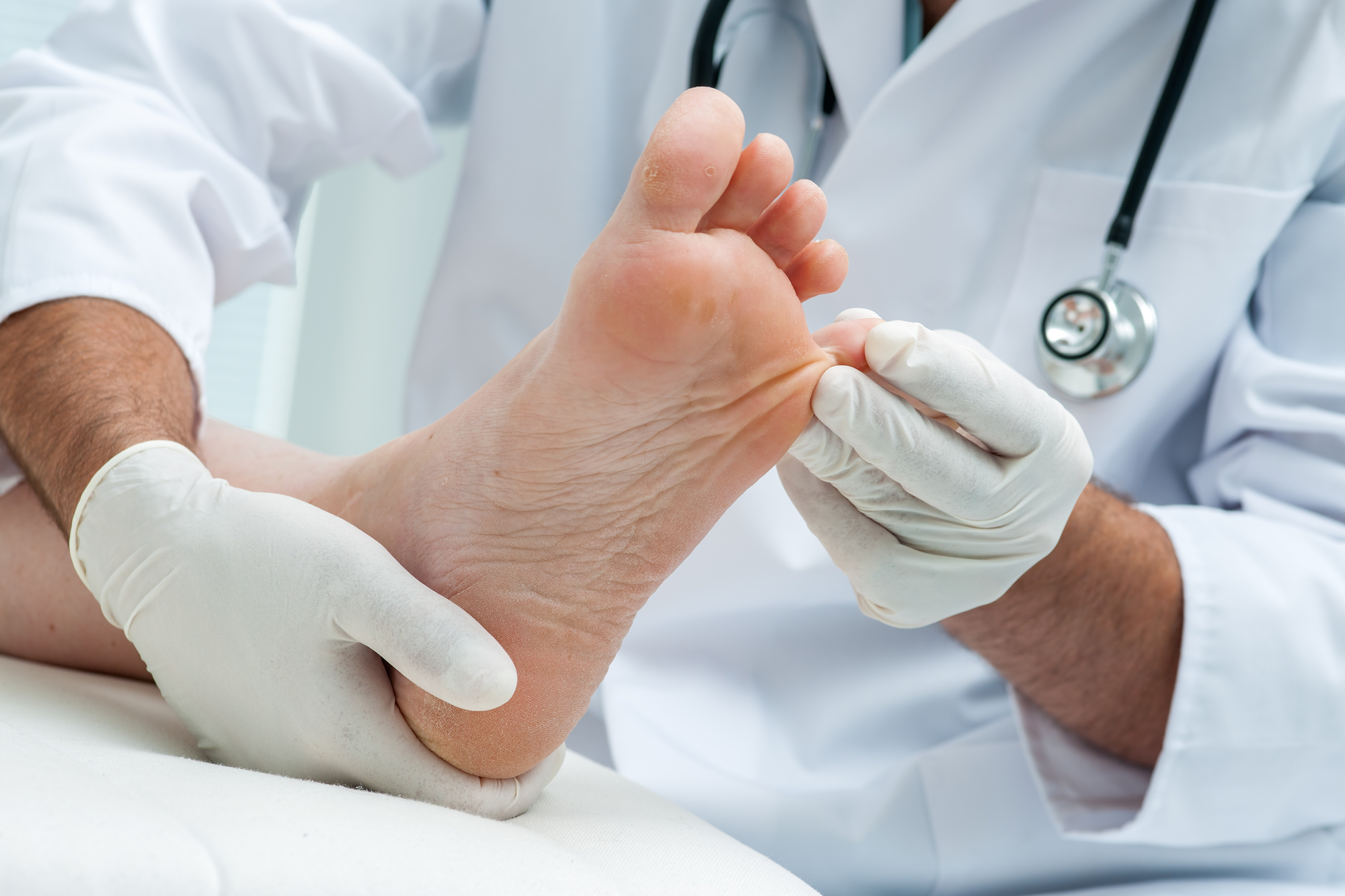 What is pain after bunion surgery like?