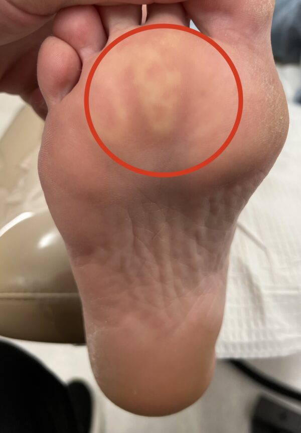Before Surgery