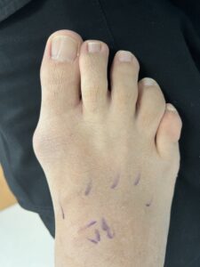 Before Surgery