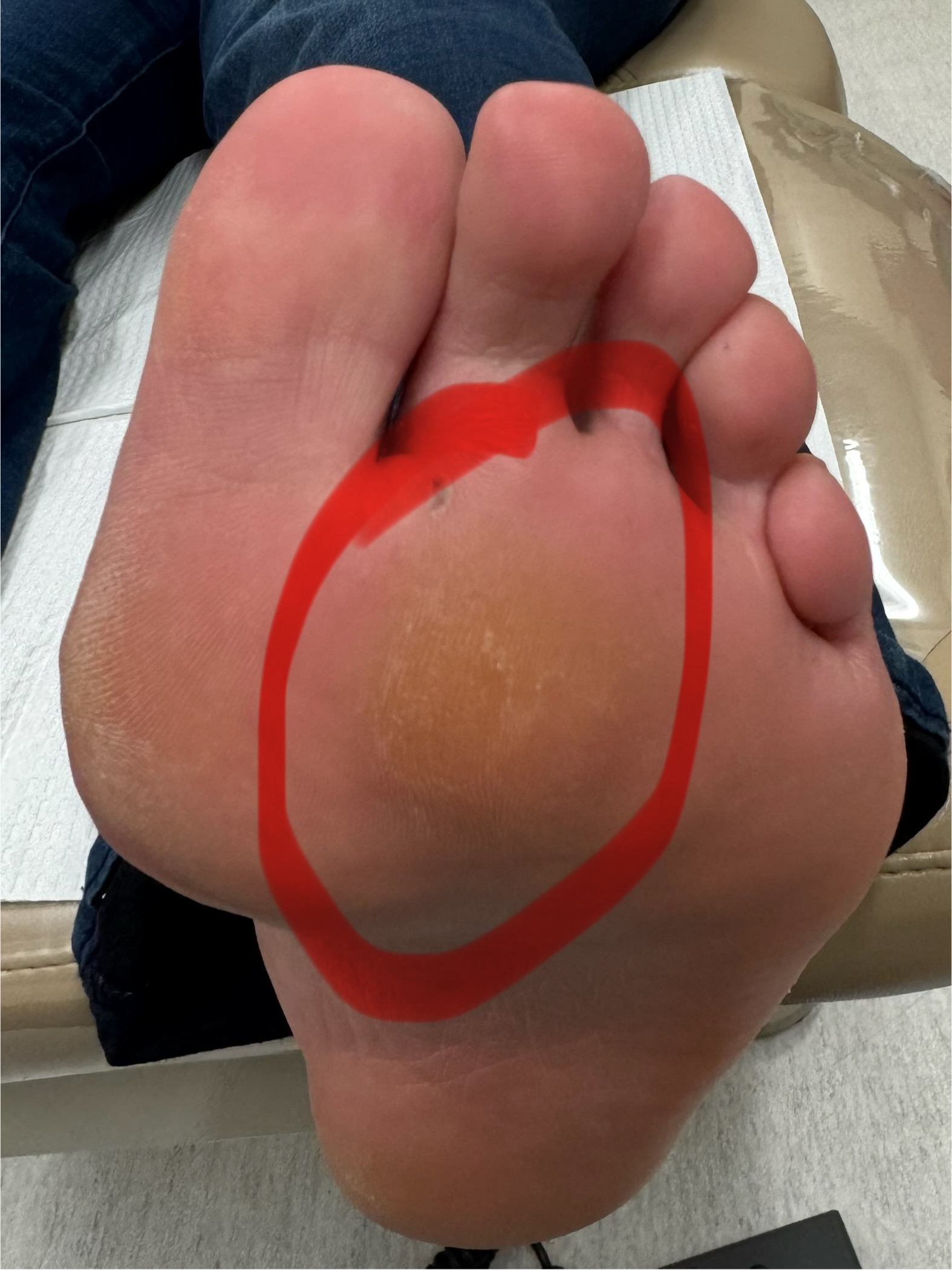 Before Surgery