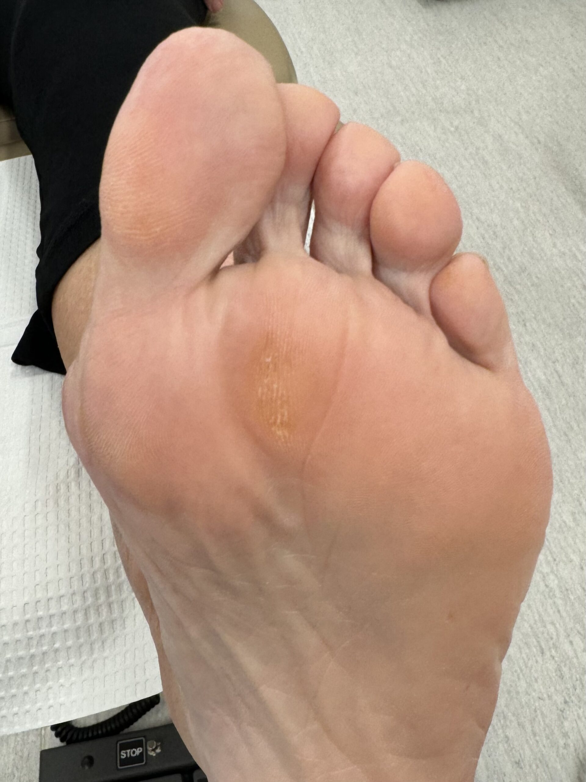 after bottom of foot