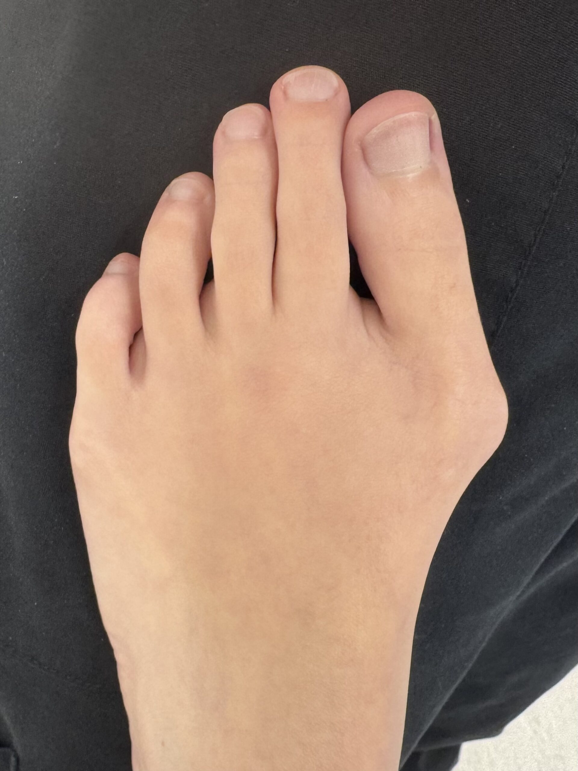 Before Surgery