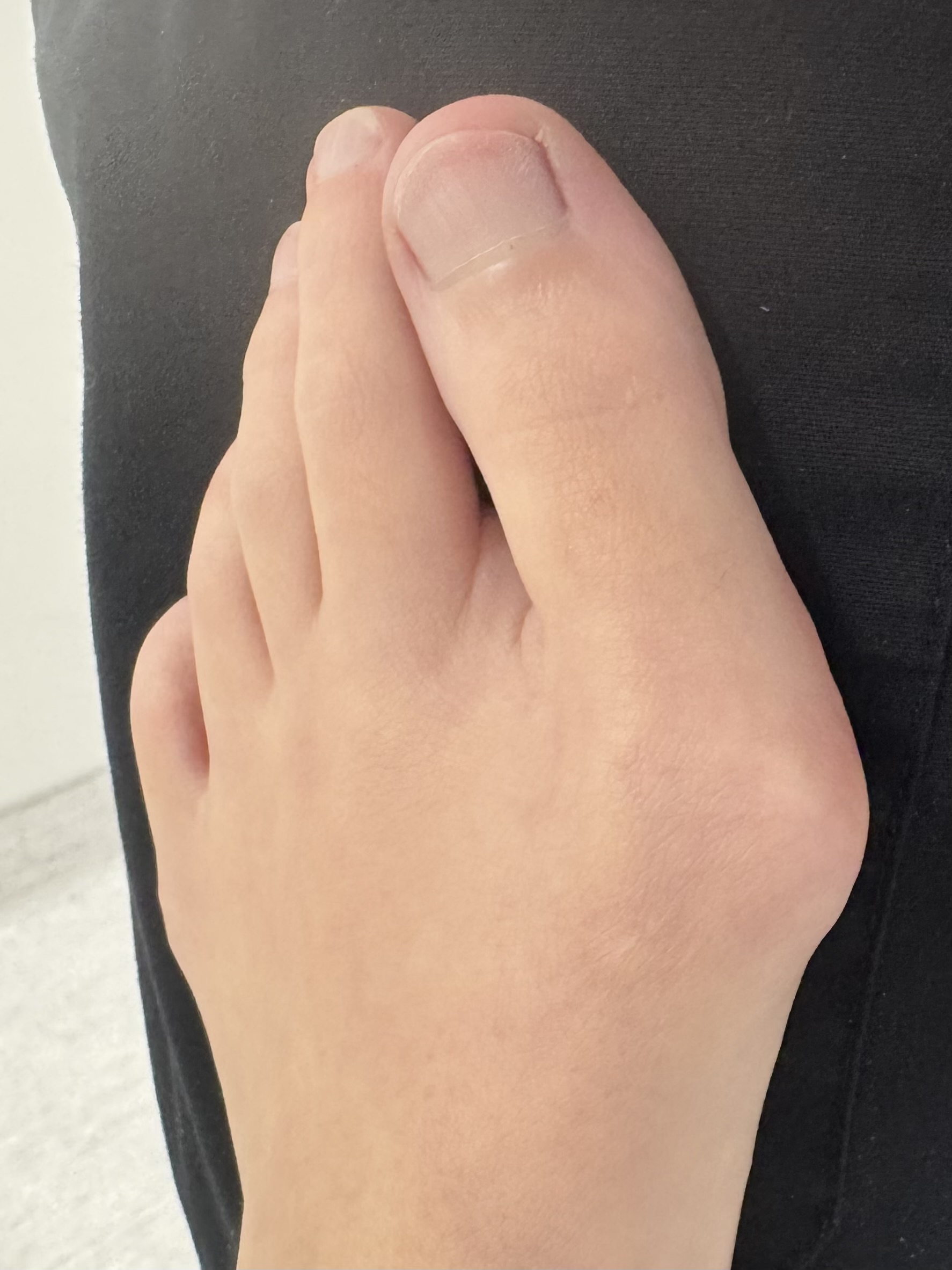 Before Surgery