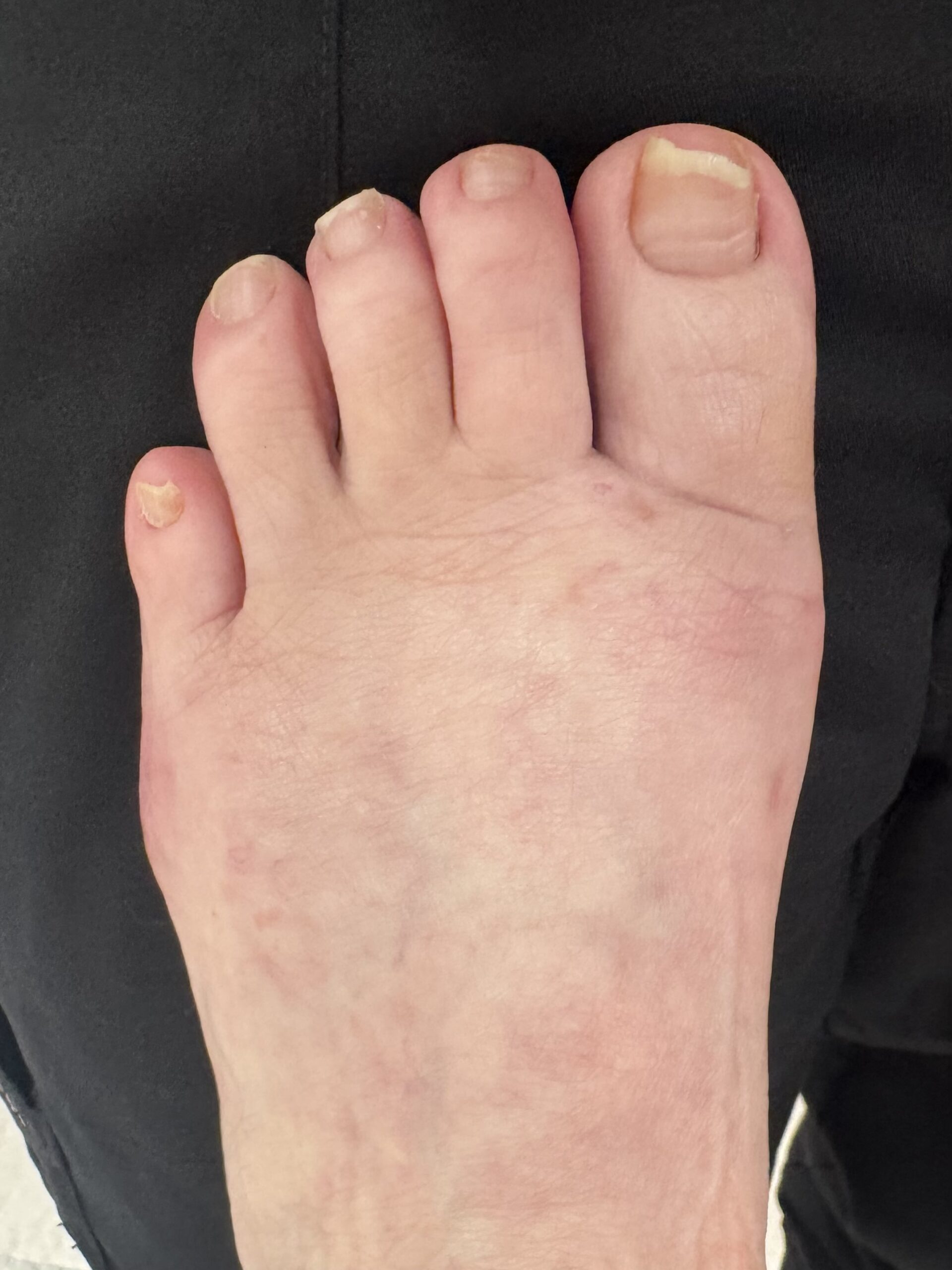 Before Surgery