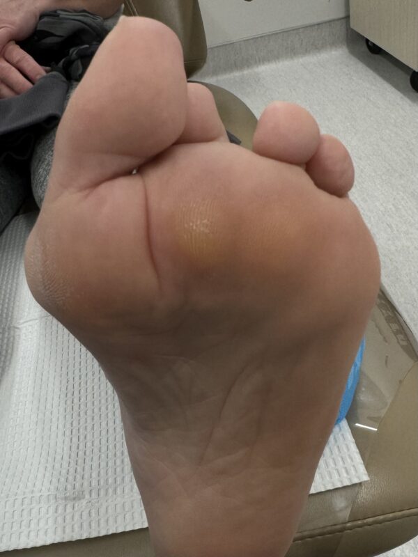 Before Surgery