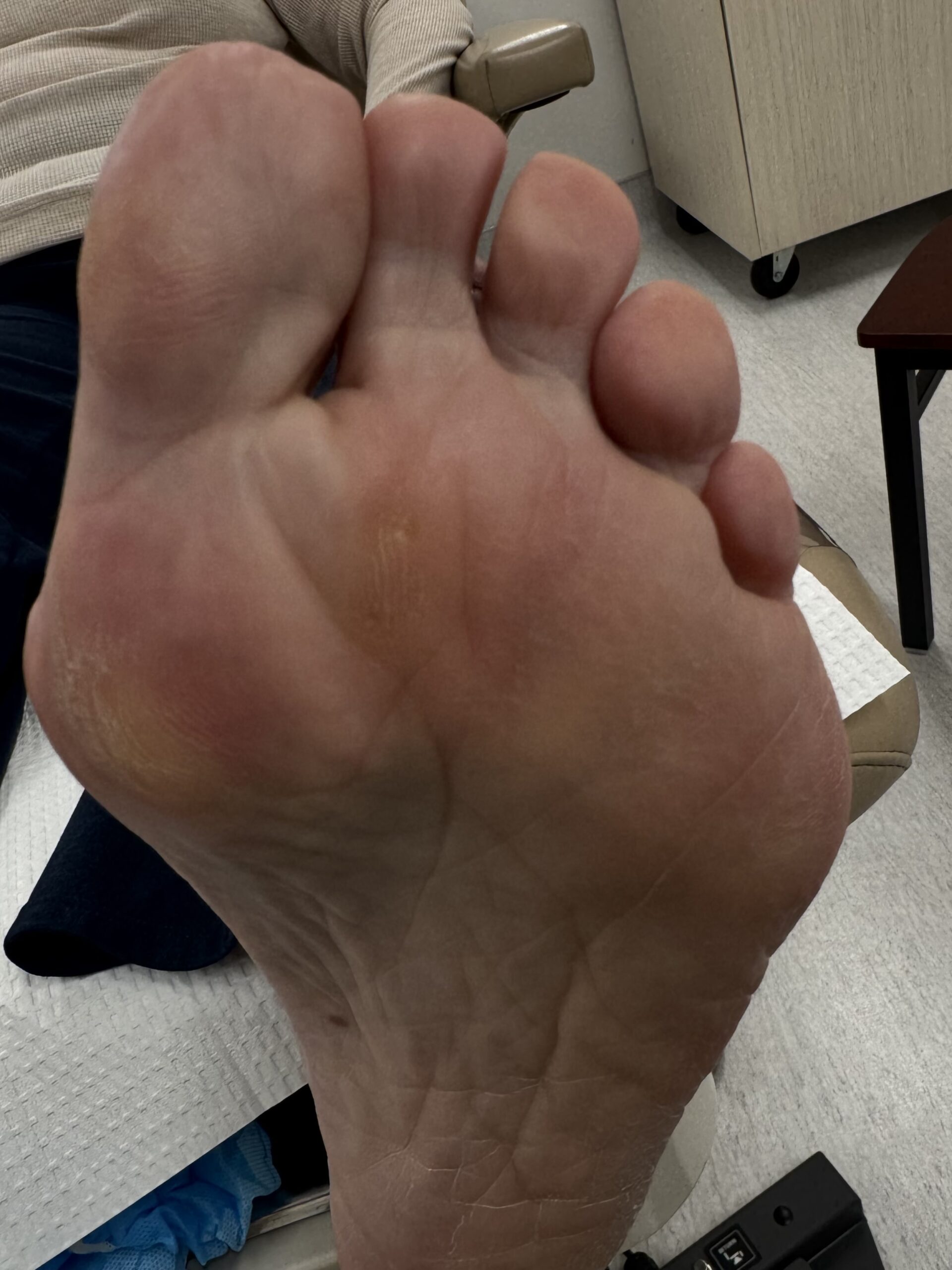 Before Surgery