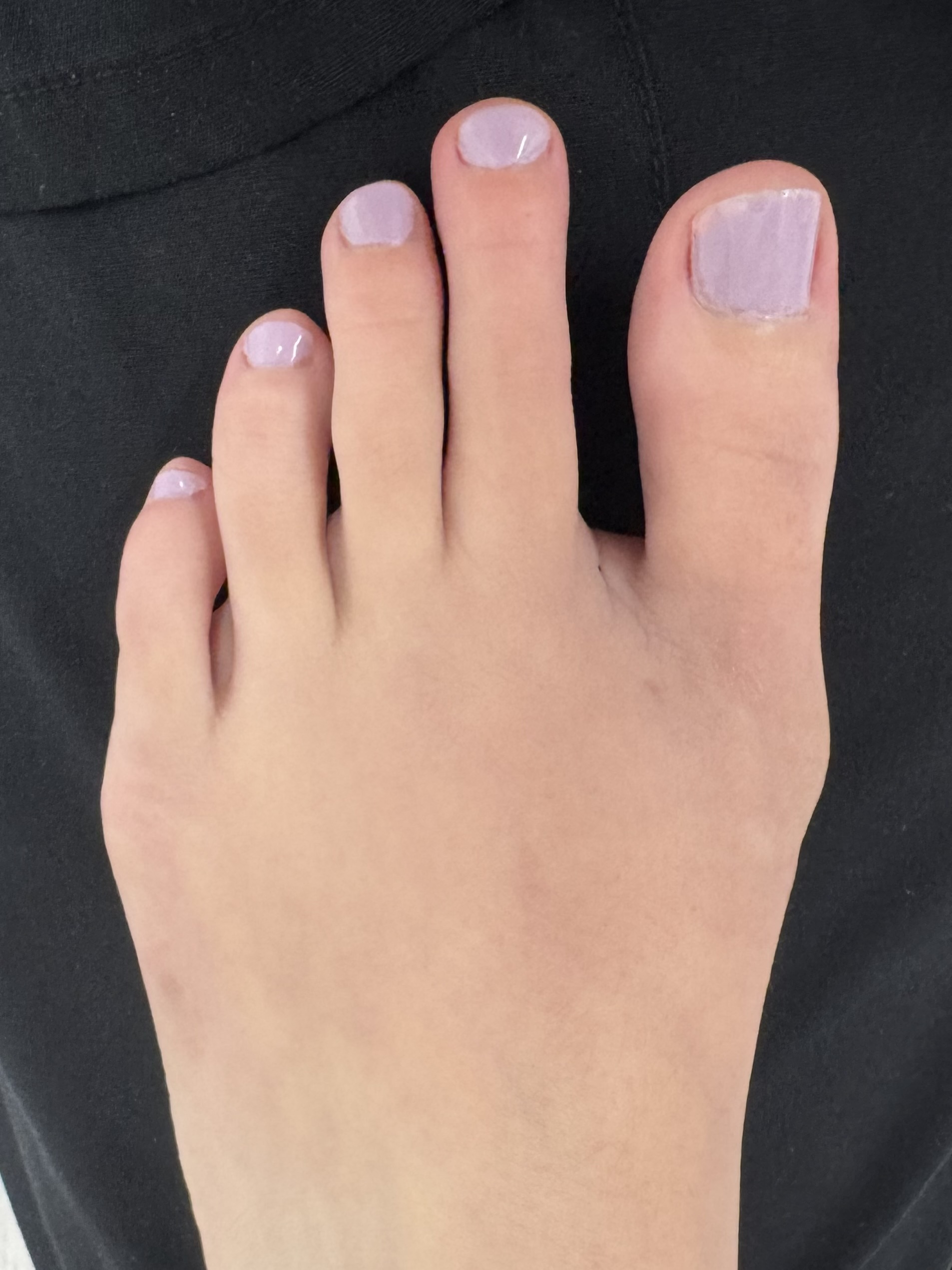 After Surgery