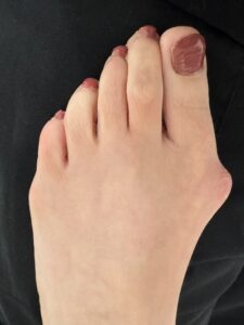 Before Surgery