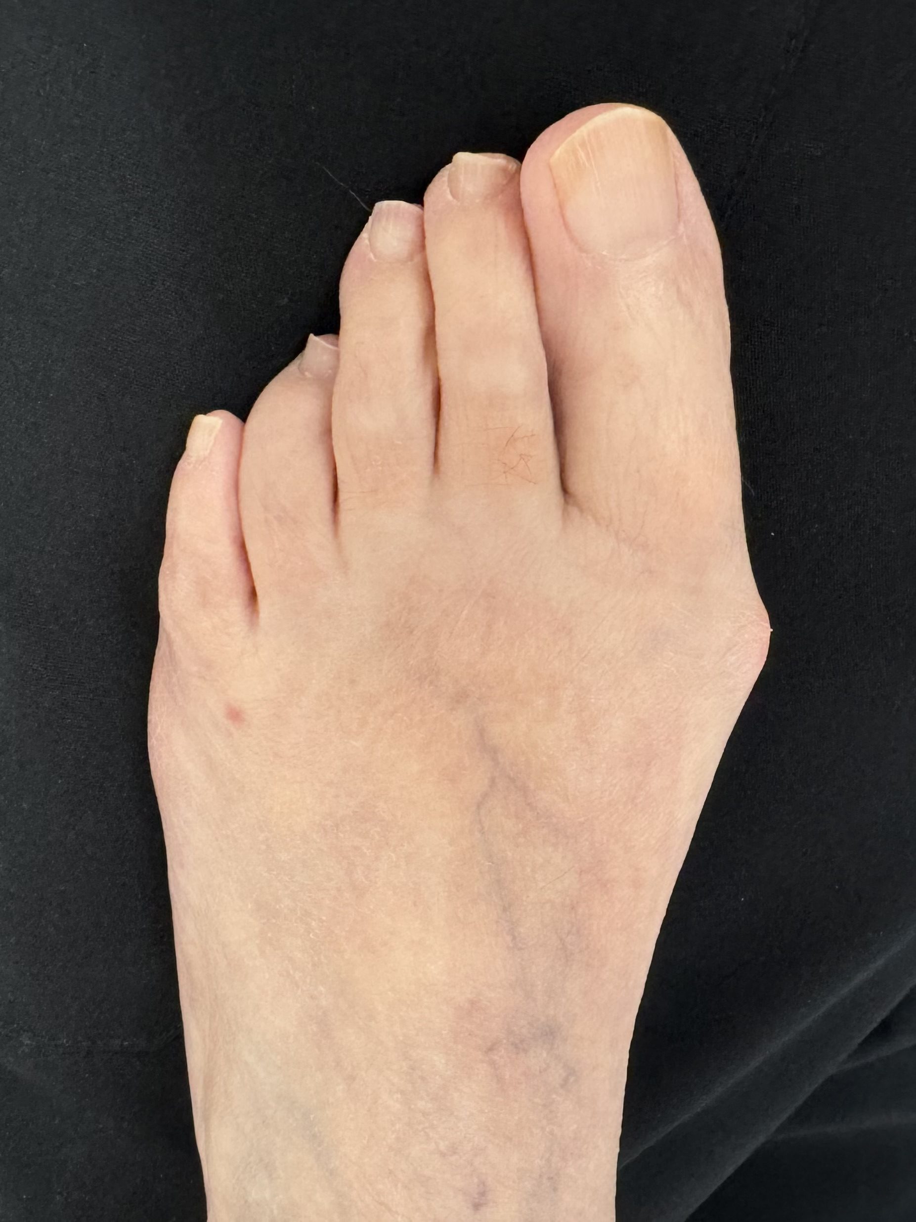 Before Surgery