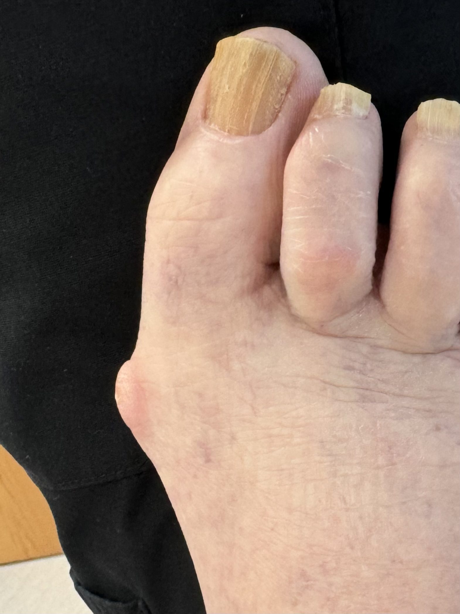 Before Surgery