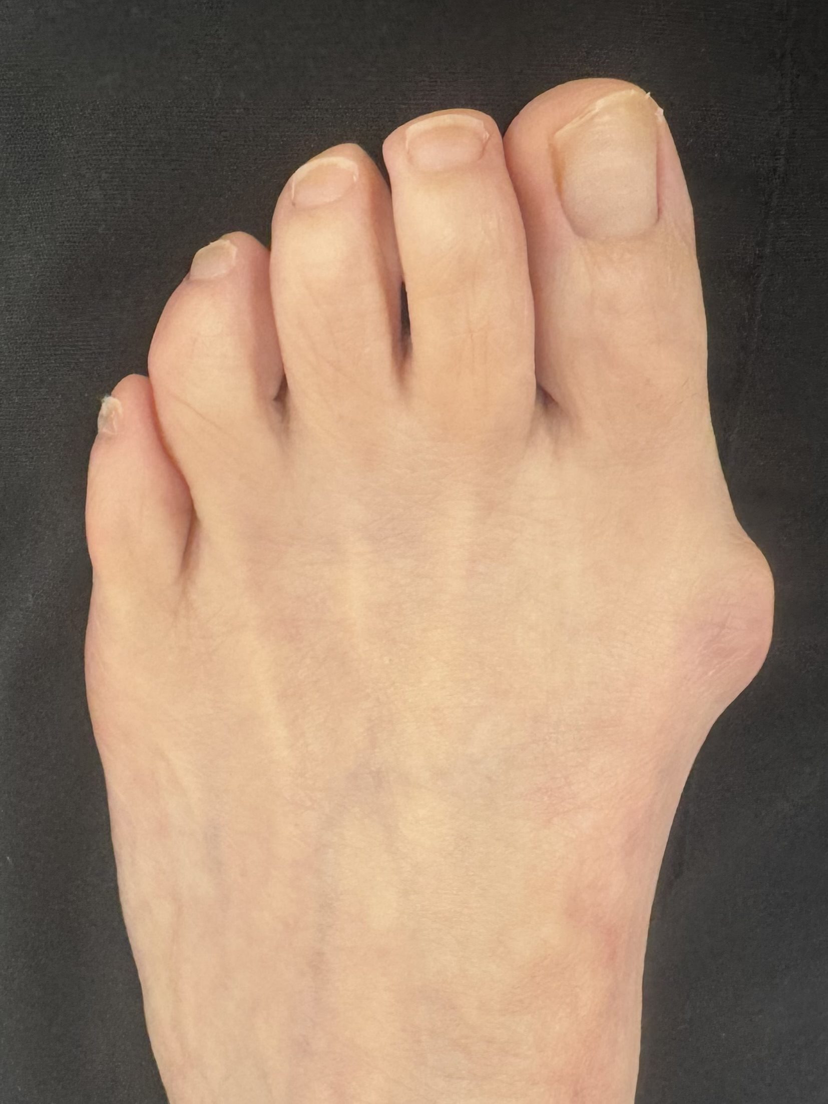 Before Surgery