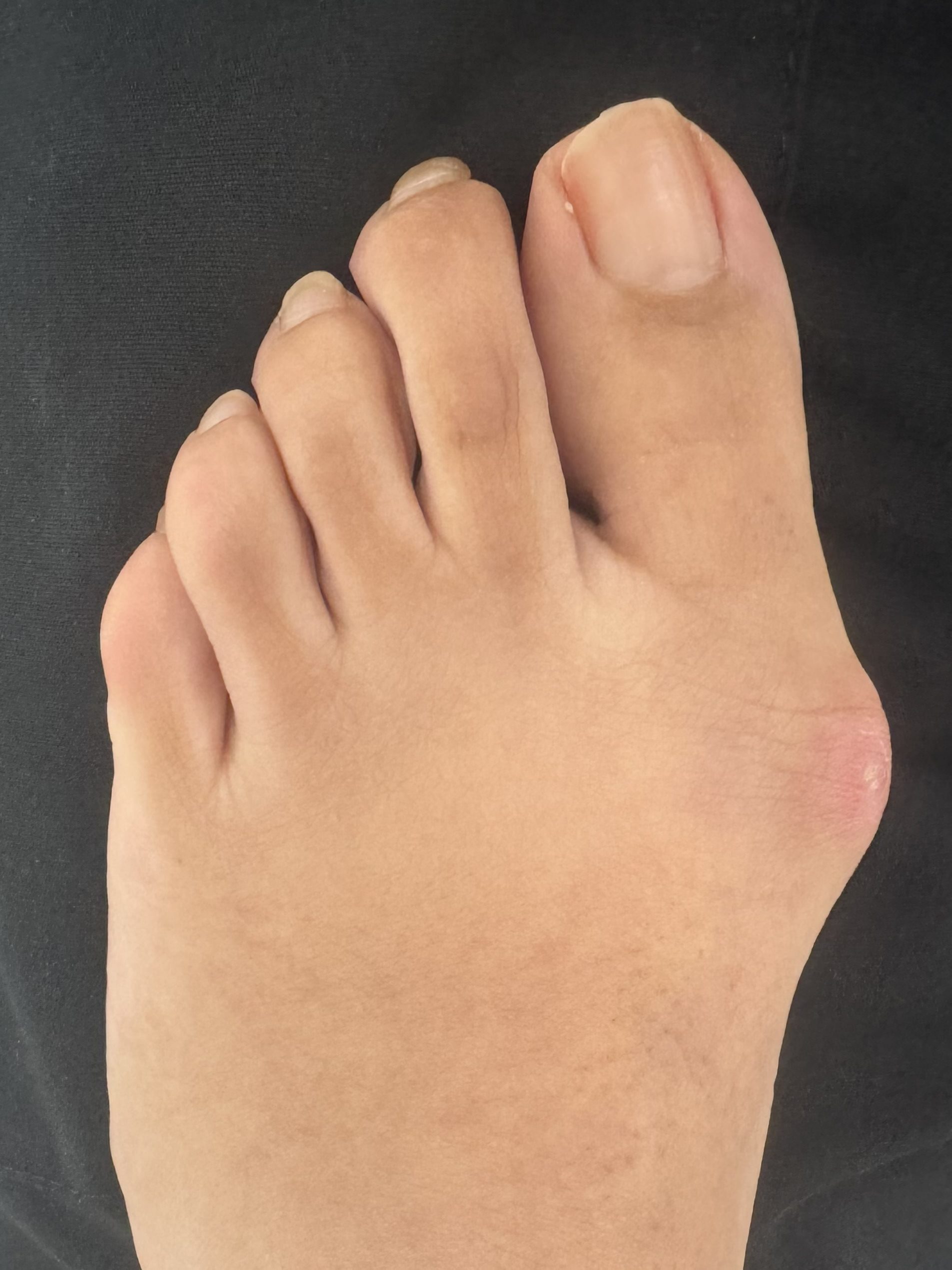 Before Surgery