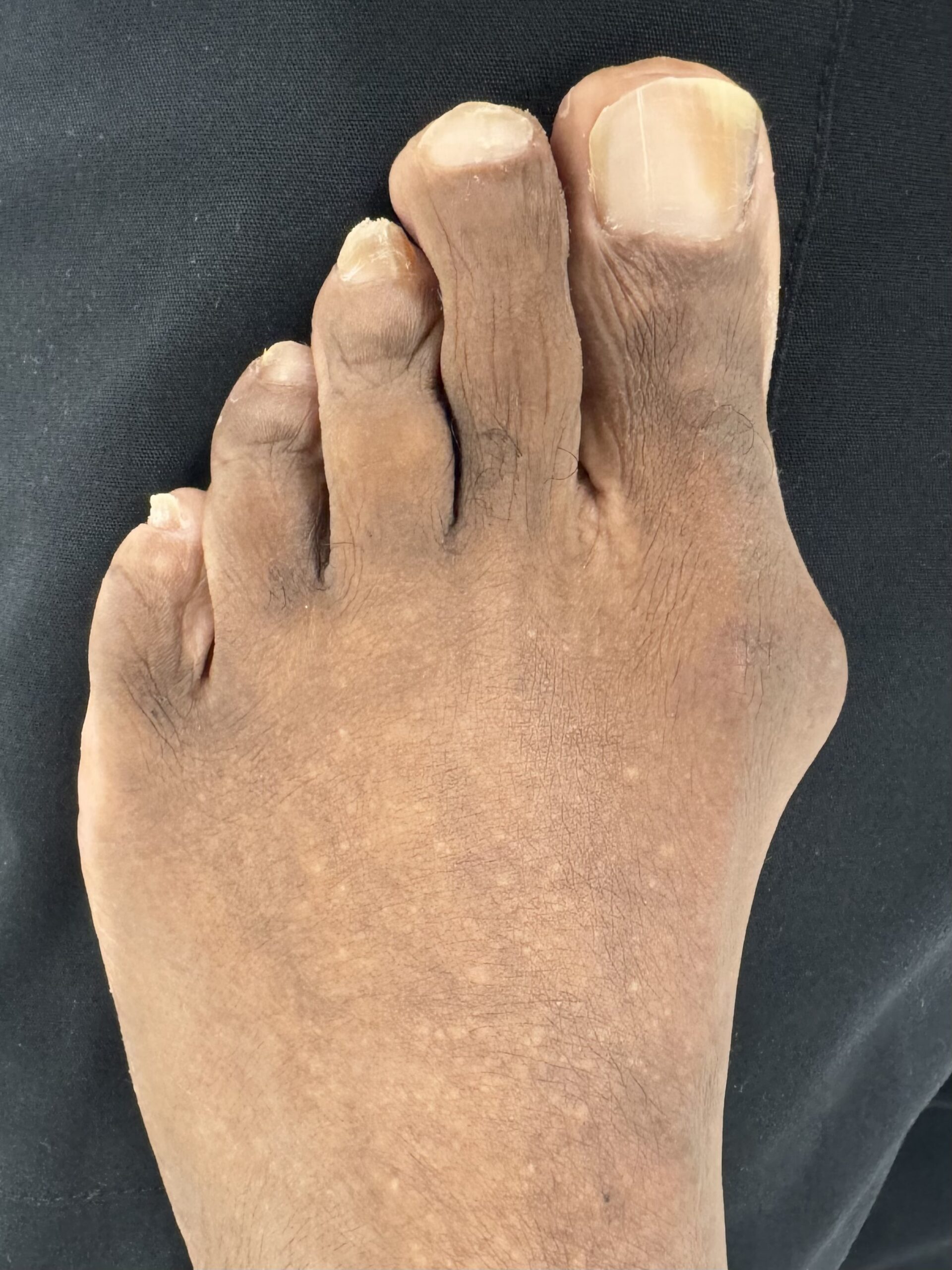 Before Surgery