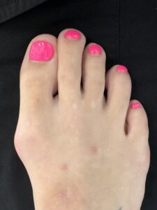 Before Surgery