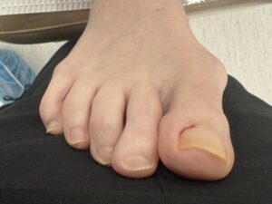 Before Surgery