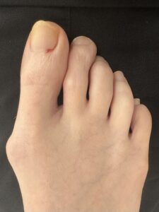 Before Surgery