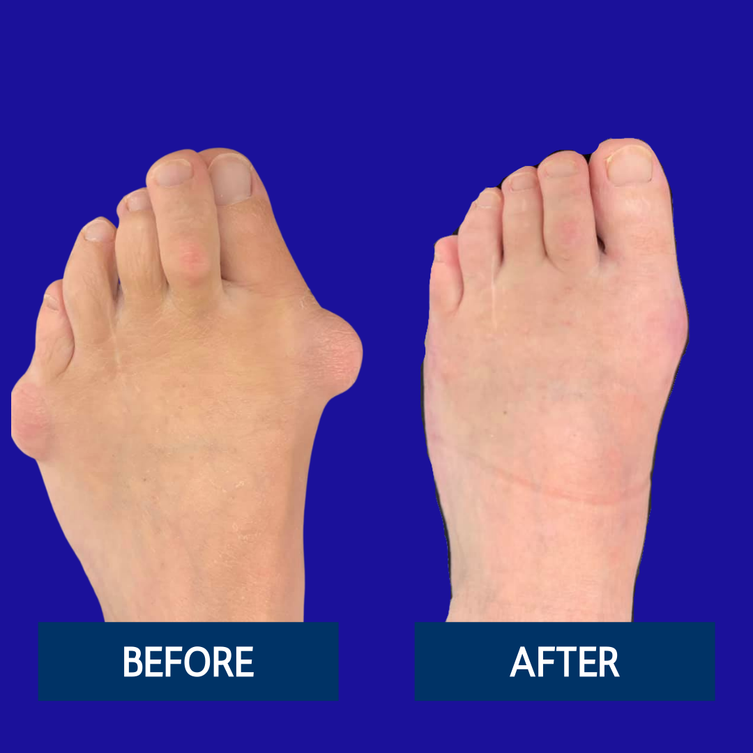 Podiatry Surgery Northwest Surgery Center Milwaukee, WI