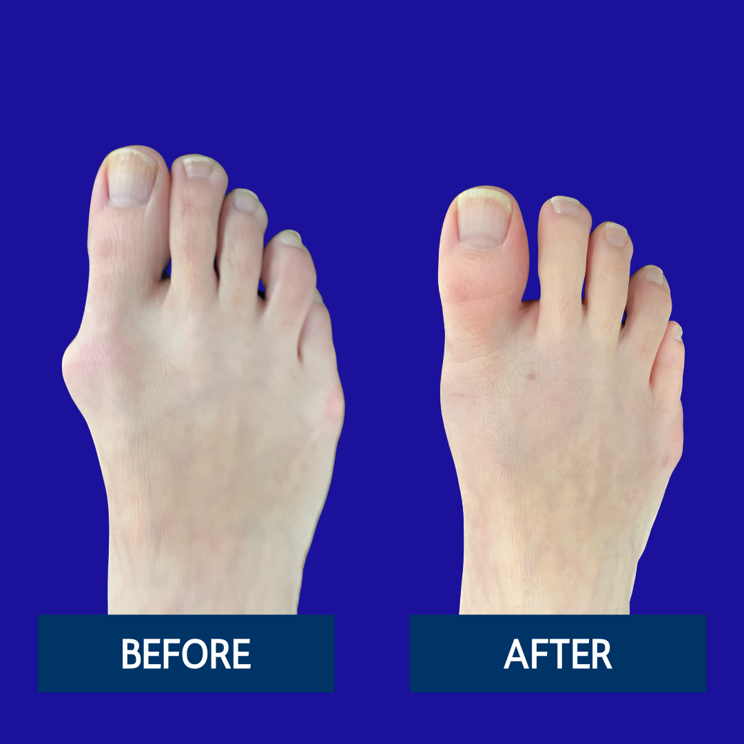 NWSC Before & After (5)
