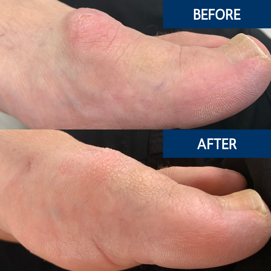 NWSC Before & After (8)