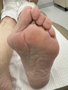 Before Surgery