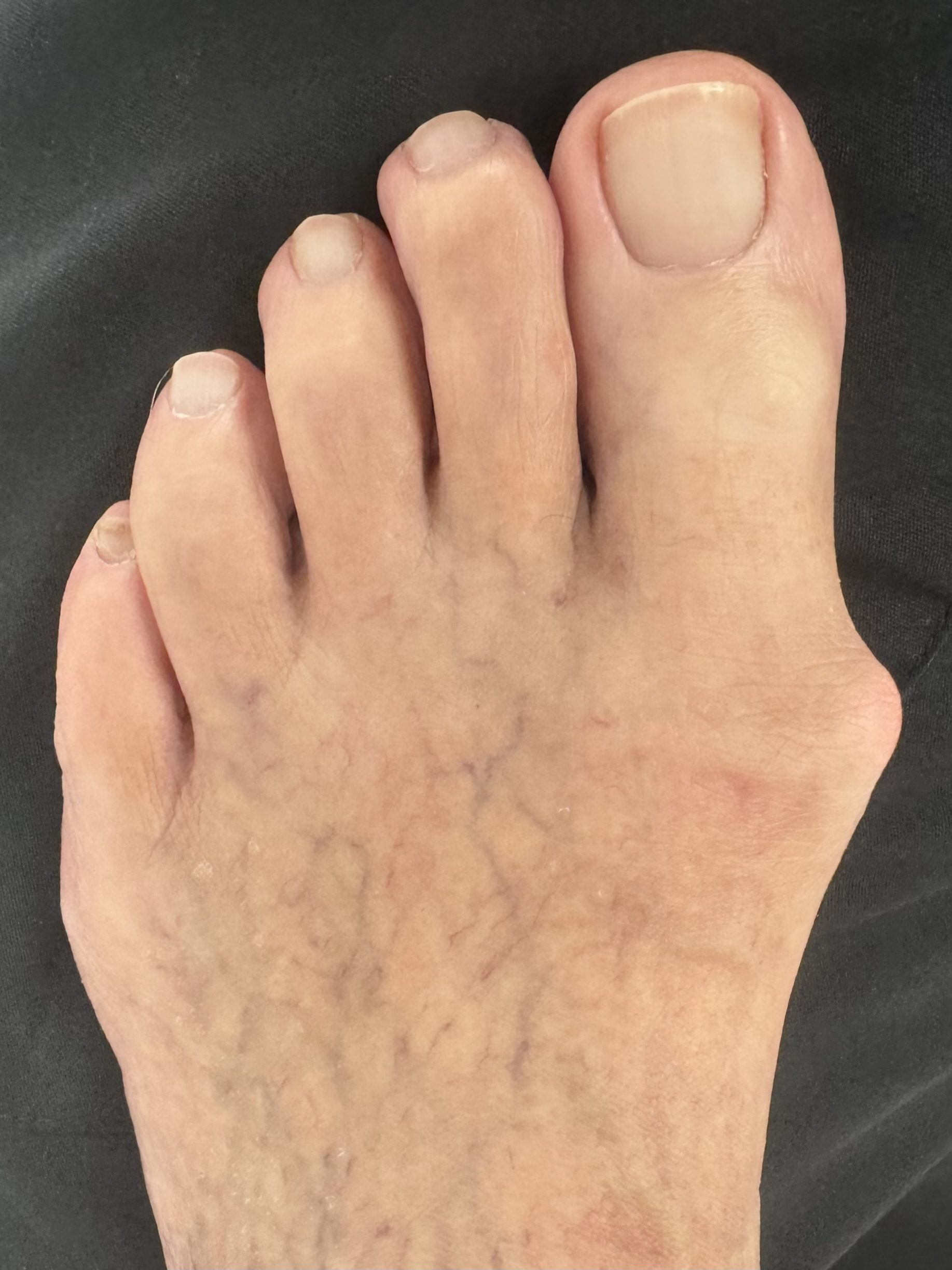 Before Surgery