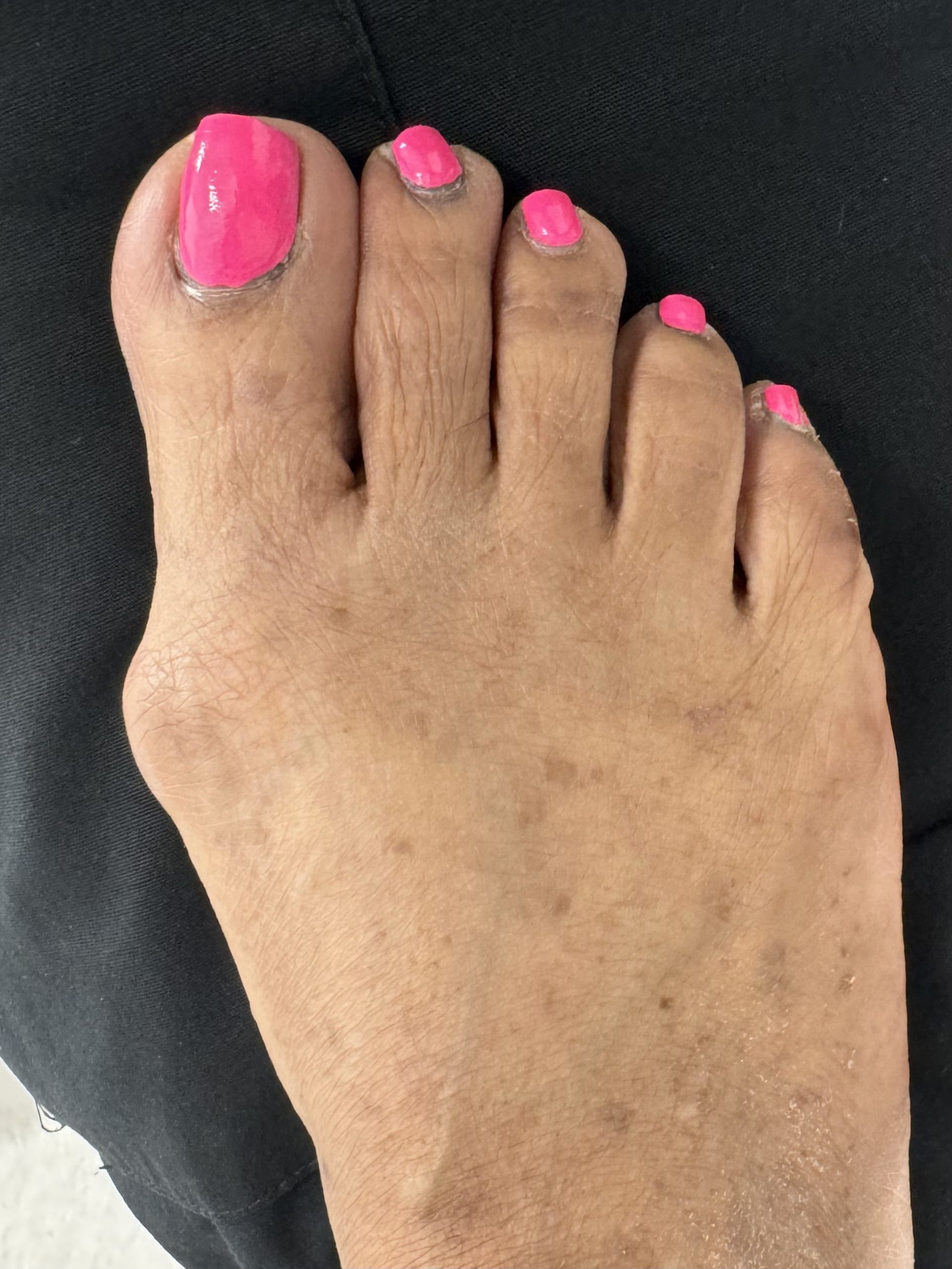 Before Surgery