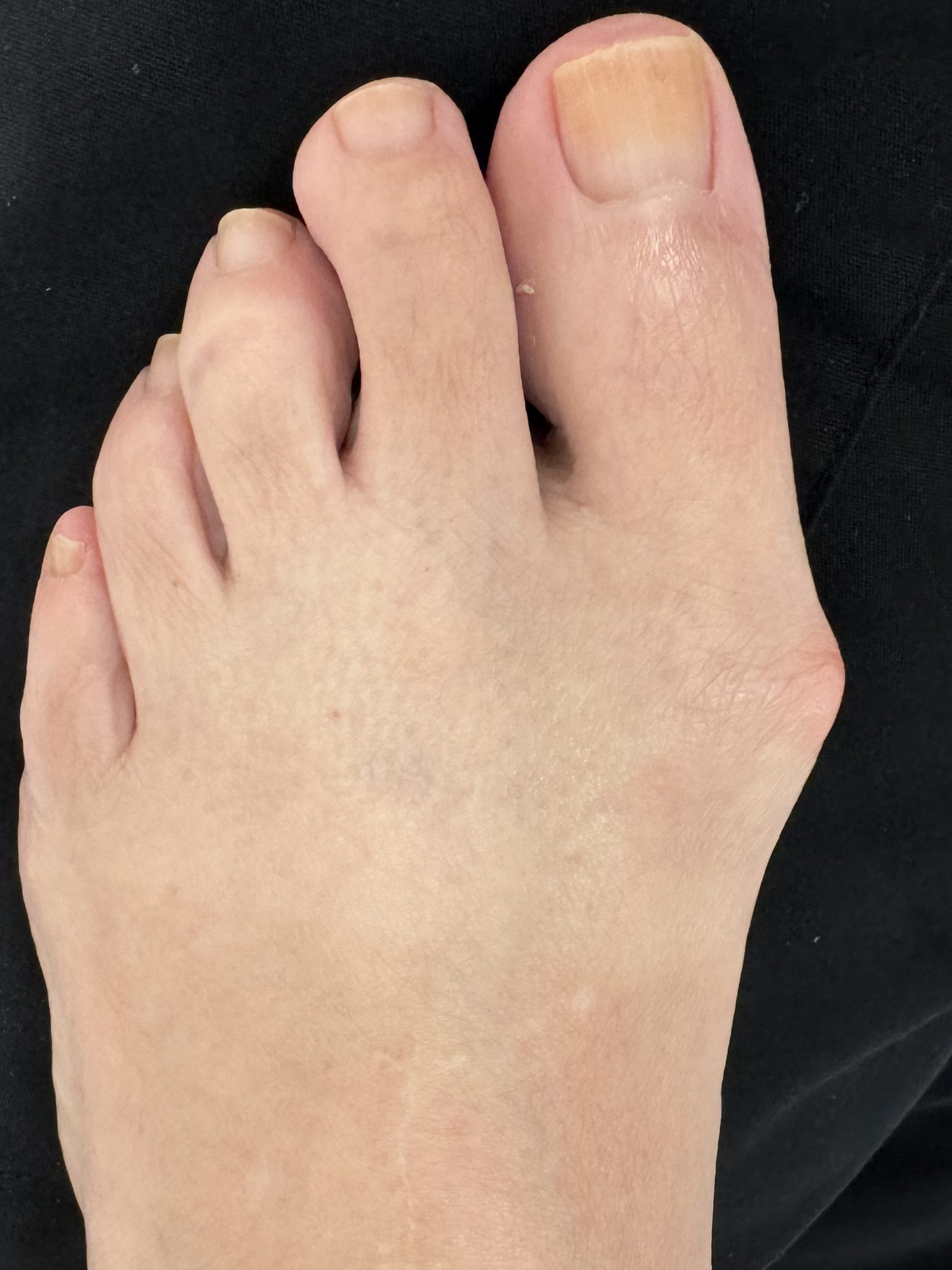 Before Surgery