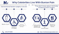 Why Celebrities Live With Bunions Infographic | Northwest Surgery Center