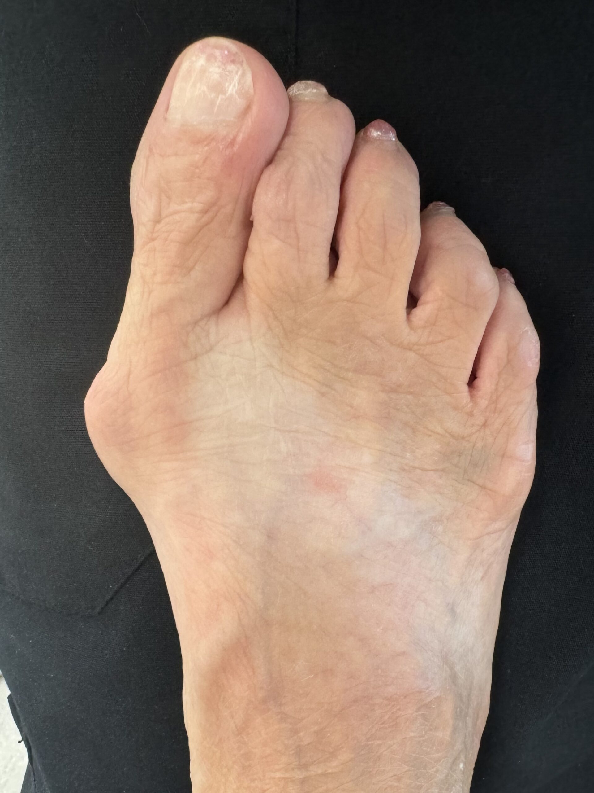 Before Surgery