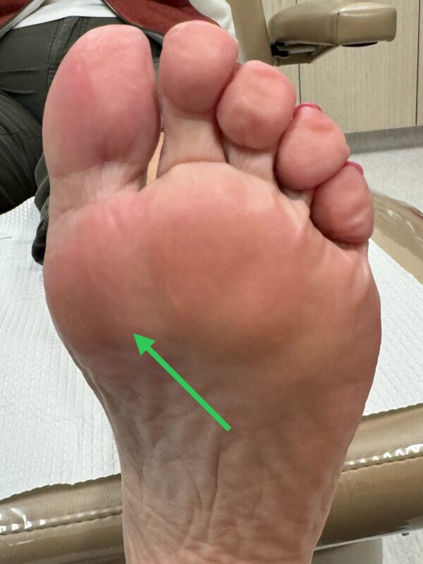 After Surgery