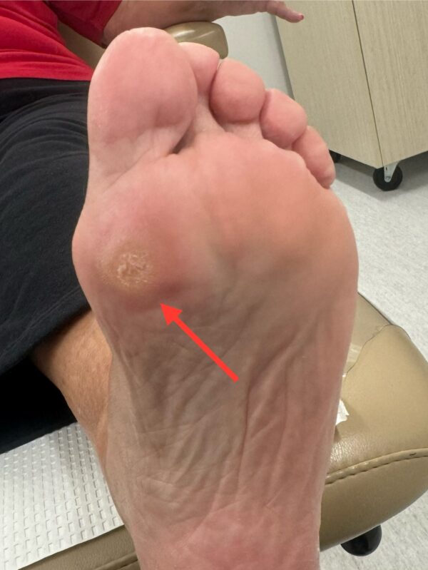 Before Surgery