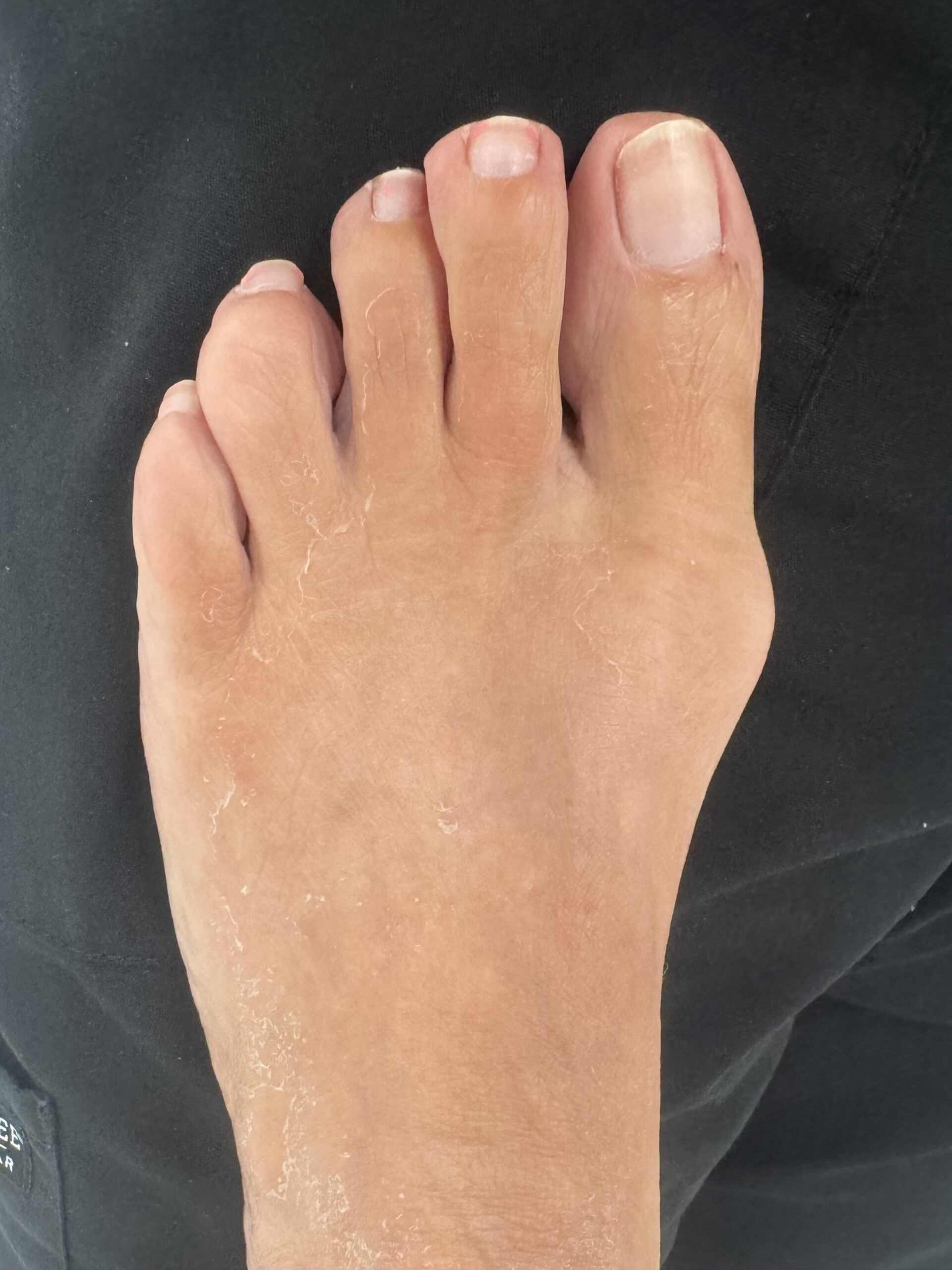 Before Surgery